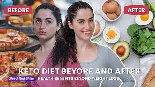 Keto Diet Before and After Health Benefits Beyond Weight Loss [upl. by Couchman]