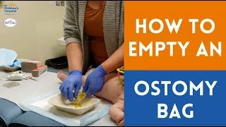 Emptying an Ostomy Bag [upl. by Thgiwd]