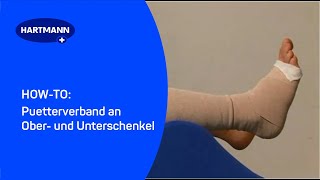 Puetterverband an Ober und Unterschenkel [upl. by Eadwine]