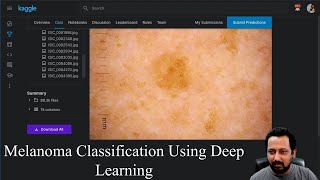 Detecting Skin Cancer Melanoma With Deep Learning [upl. by Adnilab]