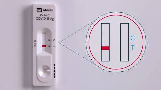 Panbio™ COVID 19 Ag Nasal Swab Procedure Live Action [upl. by Nosnek]