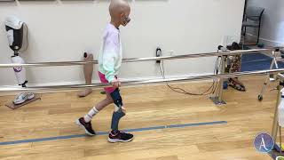 Emely first steps with rotationplasty prosthesis [upl. by Asiil668]