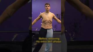 Amazing Weight Loss Transformation brodfit21  IG [upl. by Koy]