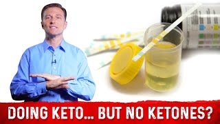 In Ketosis But No Ketones In Urine – Dr Berg [upl. by Nemraciram]