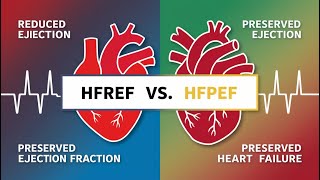 Reduced Ejection Fraction Vs Preserved Ejection Fraction [upl. by Lister]