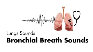 Bronchial Breath Sounds  Lung Sounds  Medzcool [upl. by Akihc993]