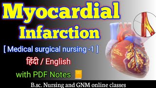 Myocardial infarction  Myocardial infarction in hindi  Myocardial infarction msn  bsc nursing 2nd [upl. by Birecree35]