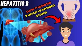 Identify Warning Signs of Hepatitis B  Signs and Symptoms of Hepatitis B [upl. by Ivers]