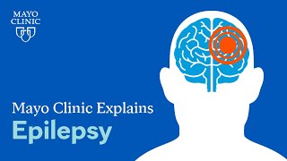 What is epilepsy A Mayo Clinic expert explains [upl. by Anilatak]