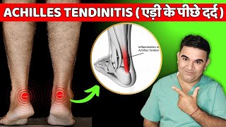 Home Treatment Plan for Achilles Tendinitis [upl. by Eedyak273]