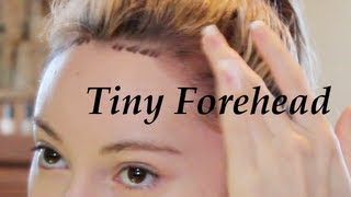 Get a Tiny Forehead Tutorial  Lower Hairline [upl. by Akli]