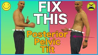 FIX Posterior Pelvic Tilt with 2 Exercises [upl. by Anrat945]