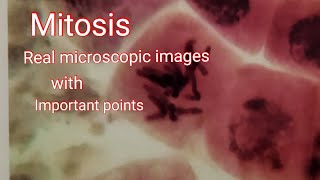 Mitosis  Real microscope image cell division with important points [upl. by Sorkin]