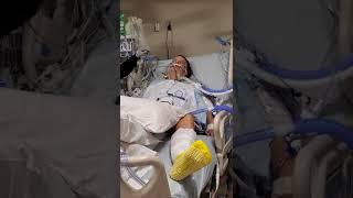 LVAD Journey  3hours after Surgery quotEXTUBATIONquot Pulling out Breathing Tube [upl. by Yde813]