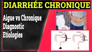 Diarrhée Chronique Définition Causes Formes Cliniques  Gastrologie Medicale [upl. by Itnavart]