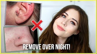 How To Get Rid Of Piercing Bumps OVERNIGHT [upl. by Luaped917]