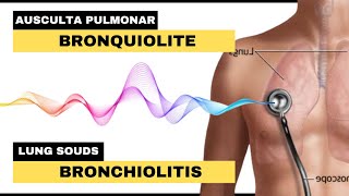 BRONQUIOLITE AUSCULTA PULMONAR  Bronchiolitis Lung Sounds [upl. by Macmahon311]