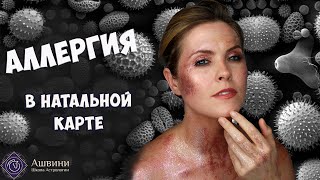 Медицинская Астрология  Аллергия в Натальной карте  Астролог Татьяна Калинина [upl. by Noet395]