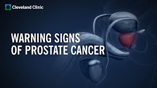 10 Warning Signs of Prostate Cancer [upl. by Aratahs]