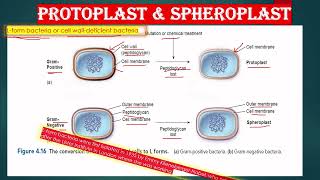 CELL WALL LESS BACTERIA AND CELL WALL DEFICIENT BACTERIA IN ENGLISH L FORM SPHEROPLAST PROTOPLAST [upl. by Whiffen]