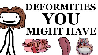 Deformities That You Might Have [upl. by Goodhen]