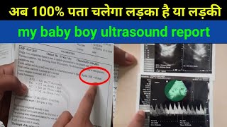 ultrasound में कहा लिखा होता है लड़का है या लड़की।baby gender prediction by sonography scan। [upl. by Balliol]