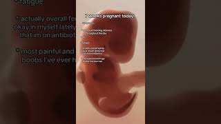 7 Weeks pregnant 7weeks pregancyultrasound pregnancyscan baby babyultrasound [upl. by Etep]