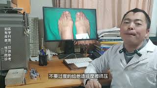 hallux valgus 拇外翻是不是会特别疼痛？如何缓解治疗 [upl. by Yerhpmuh744]