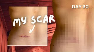 Does Red Light Therapy really work for scars 30day test w infrared sauna [upl. by Noral]