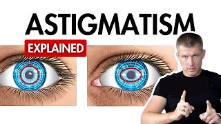 Astigmatism Treatment That Works Proven Methods to Fix Your Vision [upl. by Suiddaht]