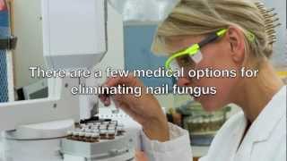 Toenail Fungus Treatment Video [upl. by Ethben]