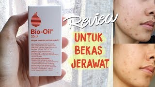 Mini Review BioOil ChitChat ENG SUBS [upl. by Mila]