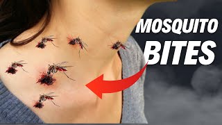 Top 6 Dangerous Mosquitoes In the World  Mosquitoe Bites [upl. by Lytsyrk94]