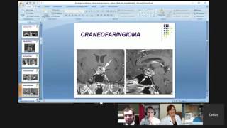 quotPituitary Tumor Managementquot Grand Internet Rounds on Neurosurgical TV [upl. by Ilyk]