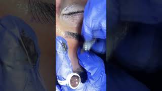 Microblading procedure  Complete Guide by Muskan Tyagi Dermalyn Aesthetics  CEOFounder [upl. by Ahsatam698]