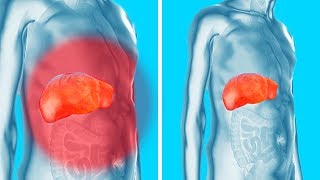 Remove Toxins from Your Kidneys Liver and Bladder Gently Yet Effectively [upl. by Eiddal]