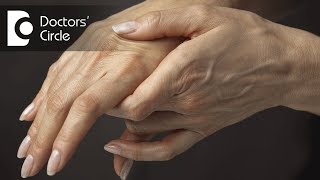 Role of homeopathy in treating Rheumatoid Arthritis  Dr Surekha Tiwari [upl. by Lrub]