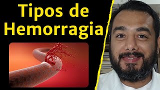 Tipos de Hemorragia – Distúrbios Hemorrágicos Curso de Patologia Humana Básica e Clínica [upl. by Bert]