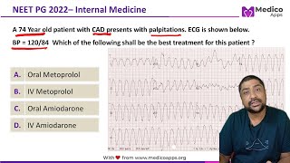 NEET PG Recall 2022 Sustained Monomorphic Ventricular Tachycardia Internal Medicine [upl. by Semajwerdna]