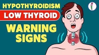 Signs that you have a Low Thyroid Level  Hypothyroidism  Signs amp Symptoms  Thyroid disease [upl. by Donica565]