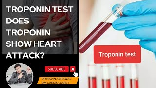 Understanding Troponin Test What You Need to Know Heart Attack Revealedquot [upl. by Linad]