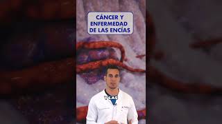 ¡Precaución El CÁNCER y su posible RELACIÓN con la ENFERMEDAD de las ENCÍAS [upl. by Aneerak]