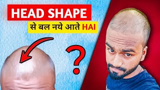 टकला होने पर Hair fall होता है ya नही 😨 hairfall [upl. by Shishko]