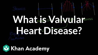 What is valvular heart disease  Circulatory System and Disease  NCLEXRN  Khan Academy [upl. by Atsyrt]