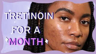 1 Month Tretinoin for Hormonal Acne  Skin Care Update [upl. by Kataway]