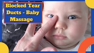 BABY BLOCKED TEAR DUCTS  Including massage video [upl. by Conner]