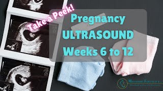 Take a Peek Weeks 6 to 12 in Pregnancy Scans  Ultrasounds [upl. by Idroj]