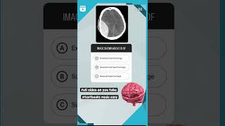 haemorrhage inicet neetmds facts dentalpractice [upl. by Fatima891]