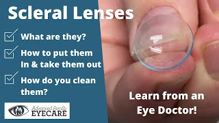 Scleral Lenses What They Are amp How to Use Them [upl. by Analla]