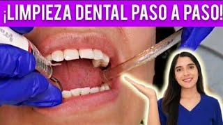 ¿CÓMO SE HACE UNA LIMPIEZA DENTAL DE CONSULTORIO  TE MUESTRO CADA PASO 🦷✅ [upl. by Torrie]